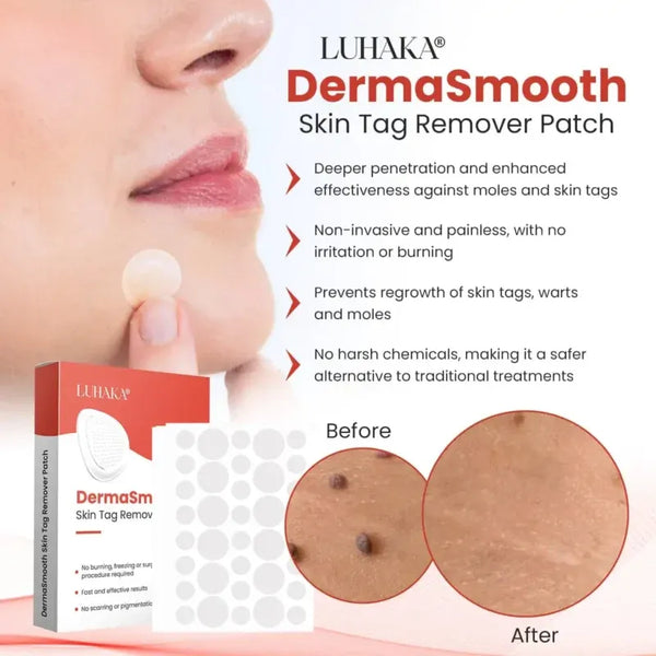 Derma Smooth Skin Tag Removal Patch | Buy 1 Get 1 Free |