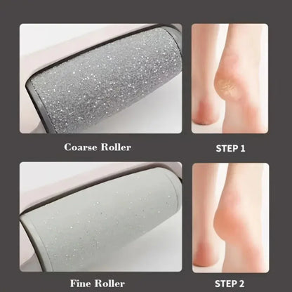 Electric Feet Callus Remover