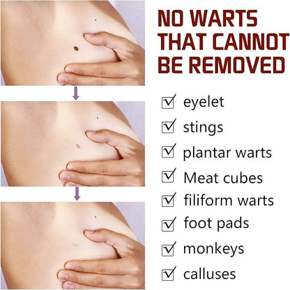 Tags and Moles Remover